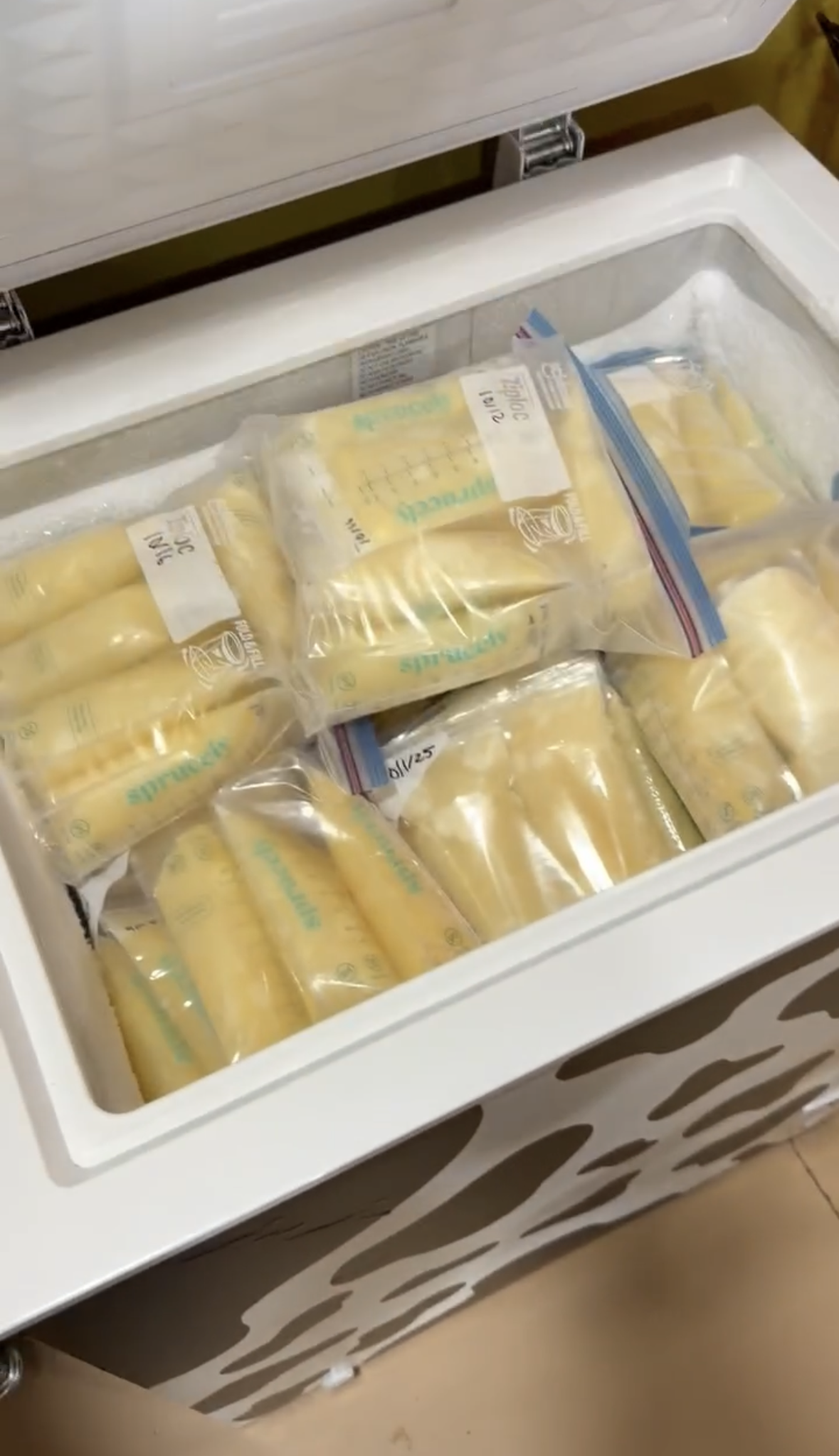 Donor Breast Milk: What It Is, When It’s Used, and What Phoenix Families Should Know