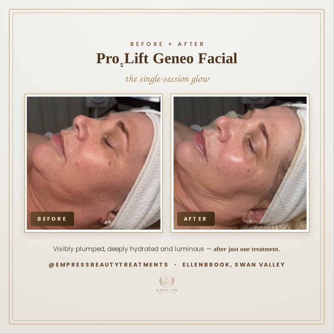 Dull. Dry. Tired-looking &mdash; even after a full night&rsquo;s sleep.
If your reflection lately feels flat, a little crepey, or just not you, you&rsquo;re not imagining it. As we get older our skin loses hydration, bounce and that lit-from-within g