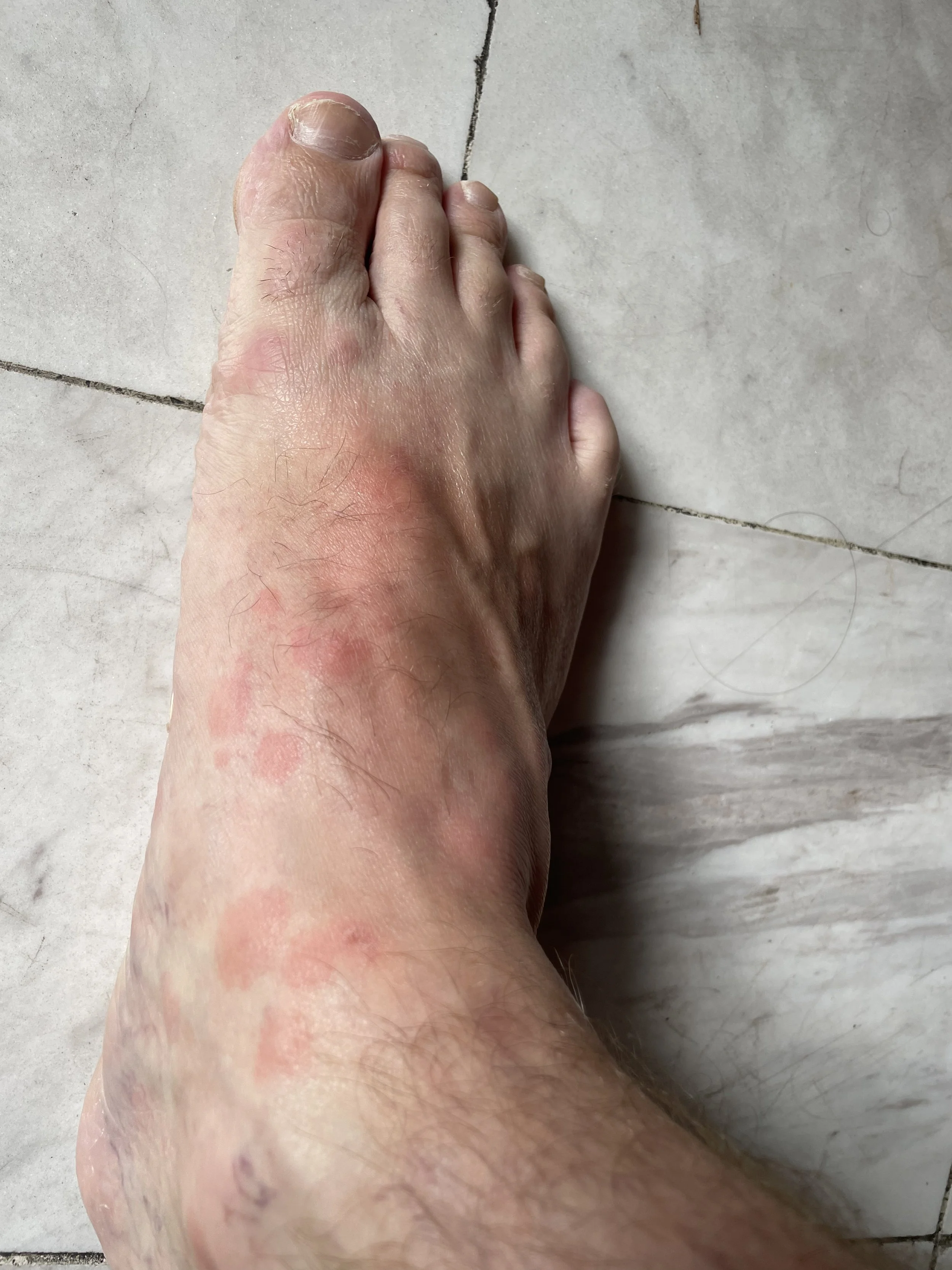‘Bangkok Foot’