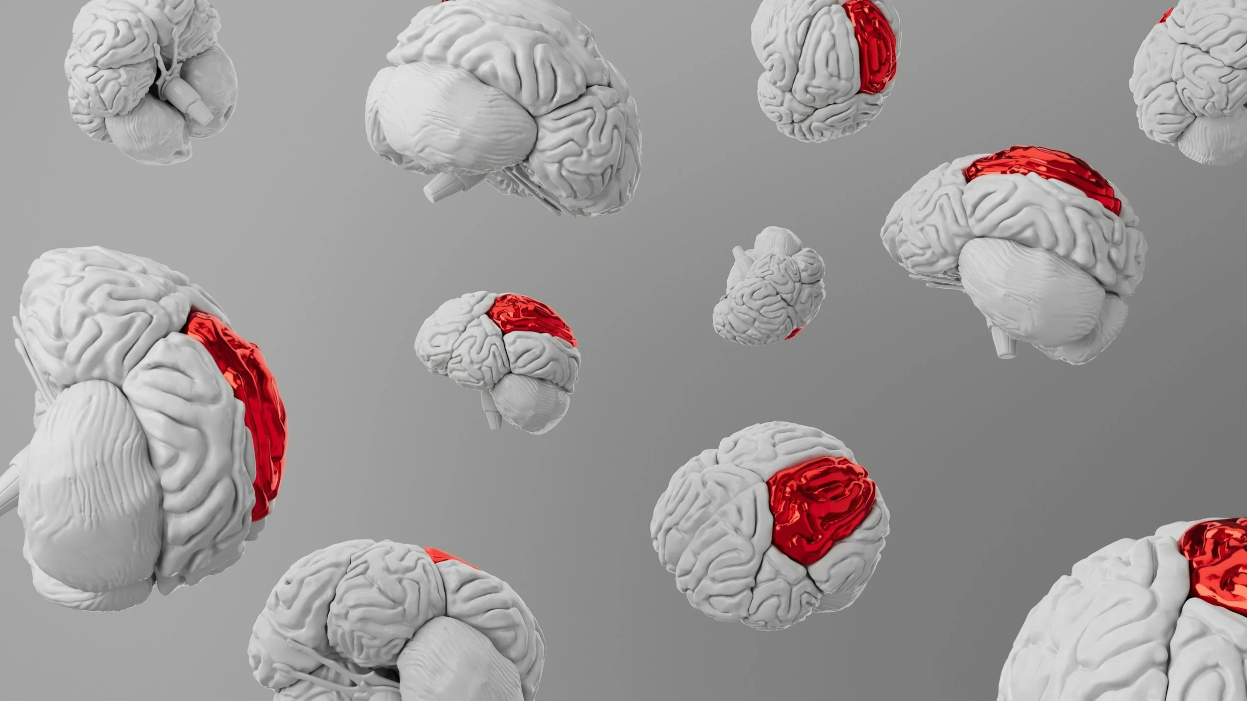 Multiple images of the brain and different areas are highlighted