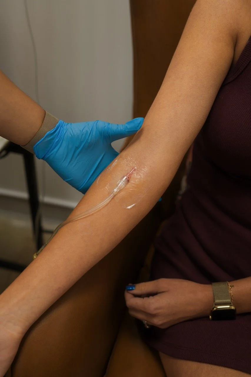 A person with a vein in their arm receiving medical treatment, an IV inserted into their arm with a transparent tube.