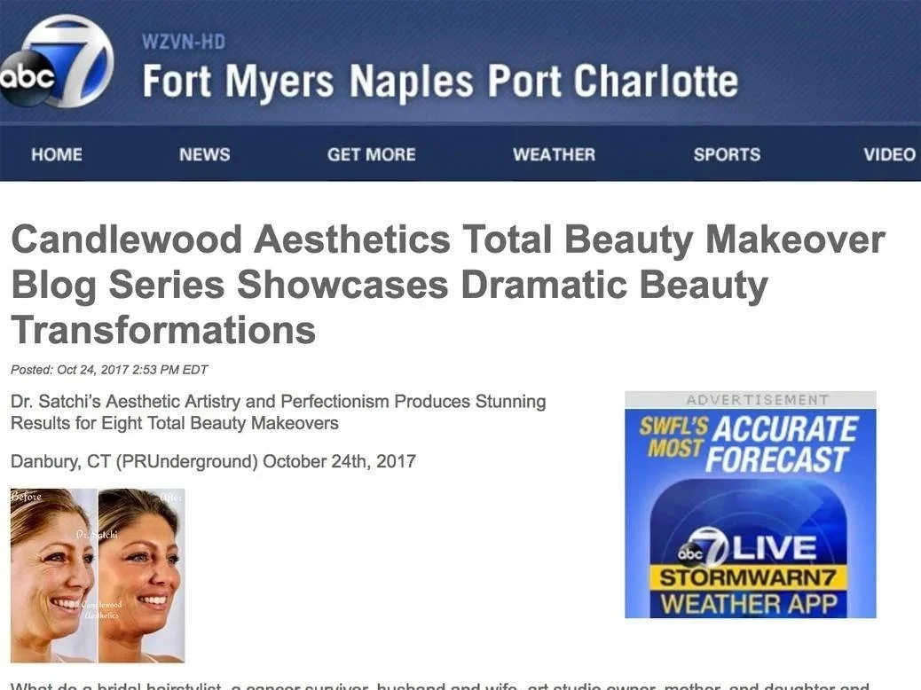 Screenshot of a news article from ABC 7 WZVN related to a beauty makeover blog series by Candlewood Aesthetics, featuring before and after photos of a woman's facial transformation.