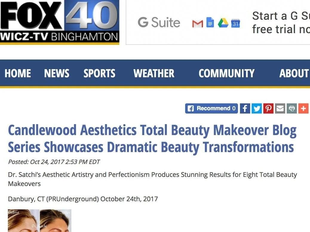 Screenshot of a news webpage from FOX 40 WICZ-TV Binghamton, titled 'Candlewood Aesthetics Total Beauty Makeover Blog Series Showcases Dramatic Beauty Transformations', featuring before and after photos of a woman's face showing a transformation.