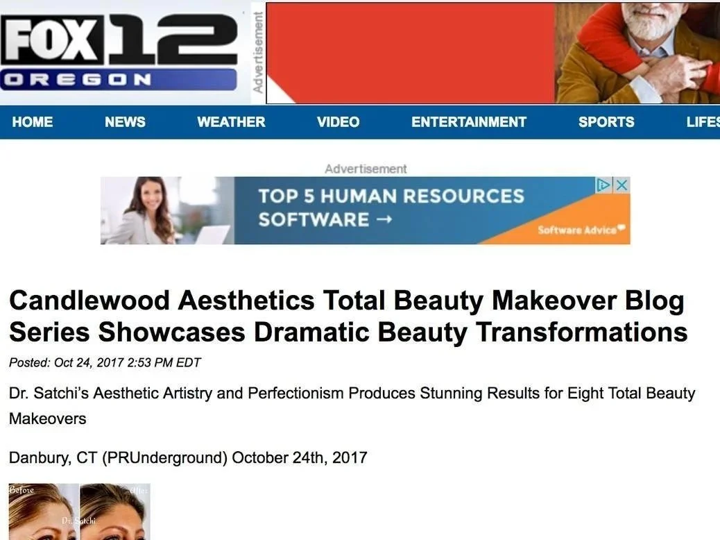 Screenshot of FOX 12 Oregon news website featuring an article about Candlewood Aesthetics' beauty makeover series, with before and after images of a woman's face.