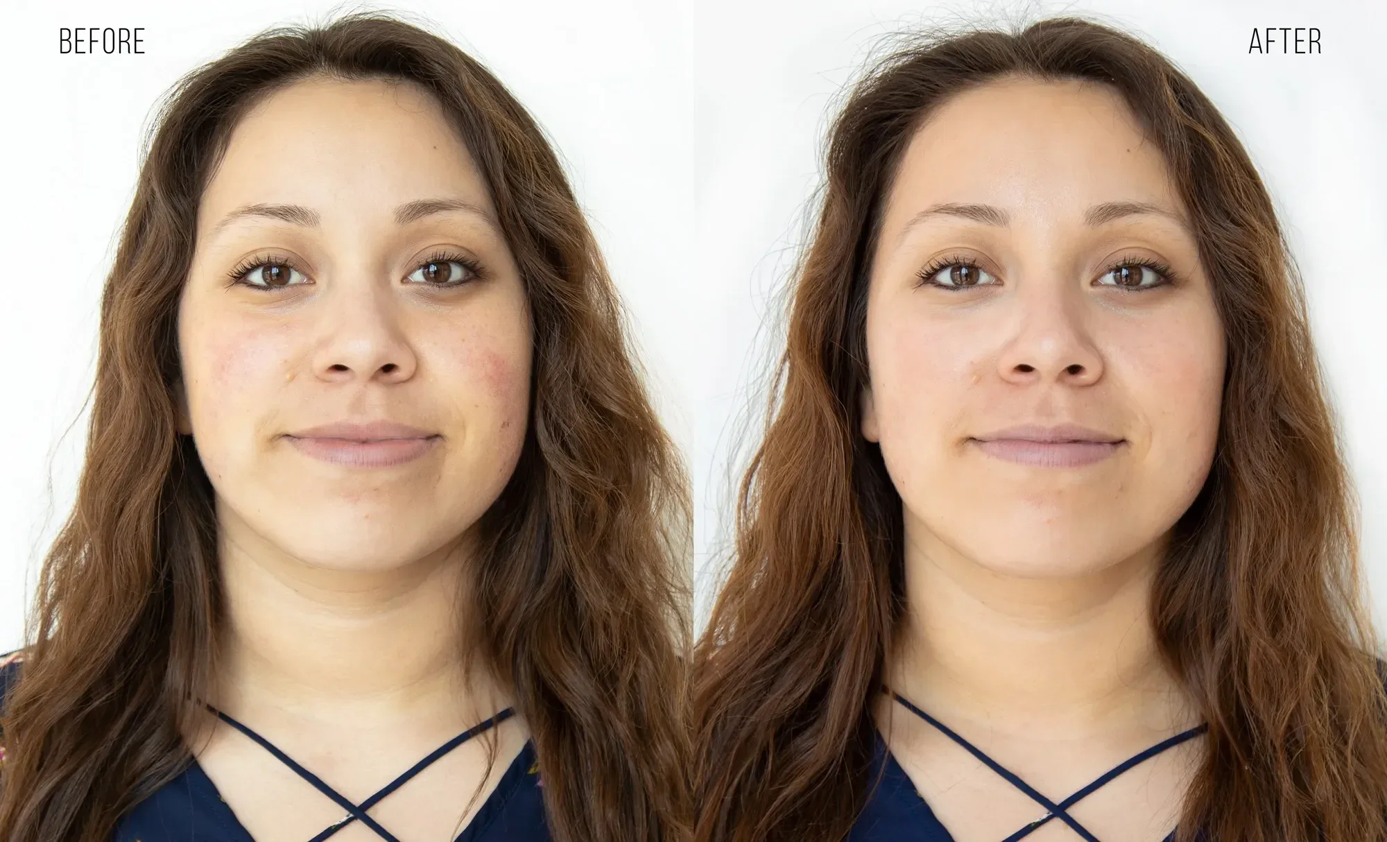 Side-by-side comparison of a woman's face before and after skincare, showing clearer skin in the after image.