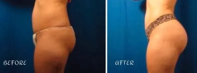 Comparison of a woman's body before and after a transformation, showing a more toned and sculpted appearance after.