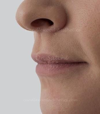 Close-up of a person's nose and lips on a neutral background.