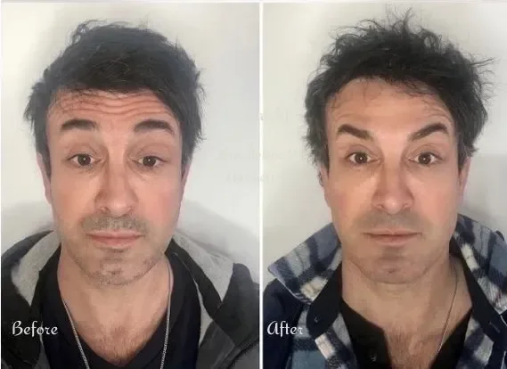 Comparison photo showing a man before and after a hairstyle change, with messy hair in the 'after' photo and neatly styled hair in the 'before' photo.
