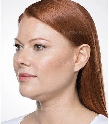 Close-up of a woman with red hair and fair skin looking to the side.