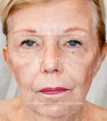 Close-up of an elderly woman's face with light skin, blue eyes, and short blonde hair, looking directly at the camera.