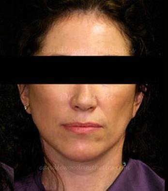 A woman with dark hair wearing a dark purple top, with a black bar covering her eyes.