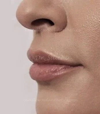 Close-up of a person's nose and lips, showing smooth skin.