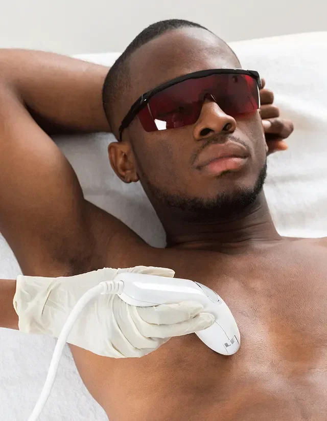 LASER HAIR REMOVAL