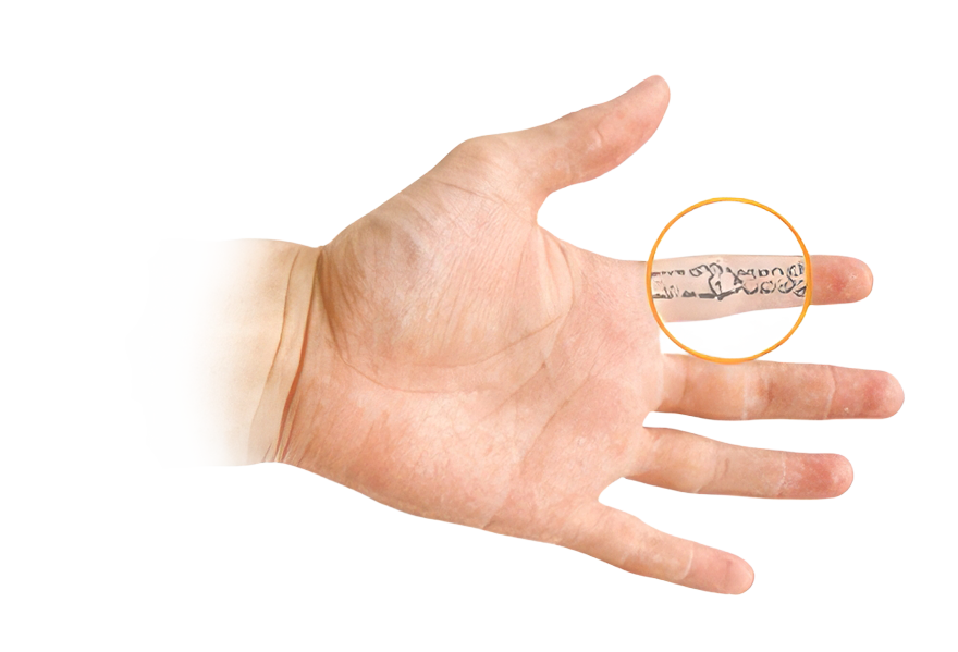 Glenn D. Cohen, M.D. | Orthopedic Surgeon - Hand, Wrist, & Elbow Disorders