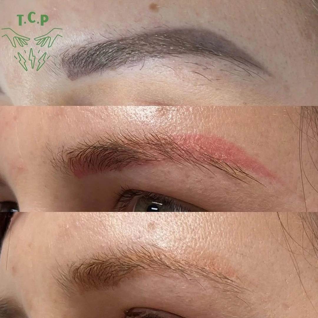 1st and 2nd treatment.jpg