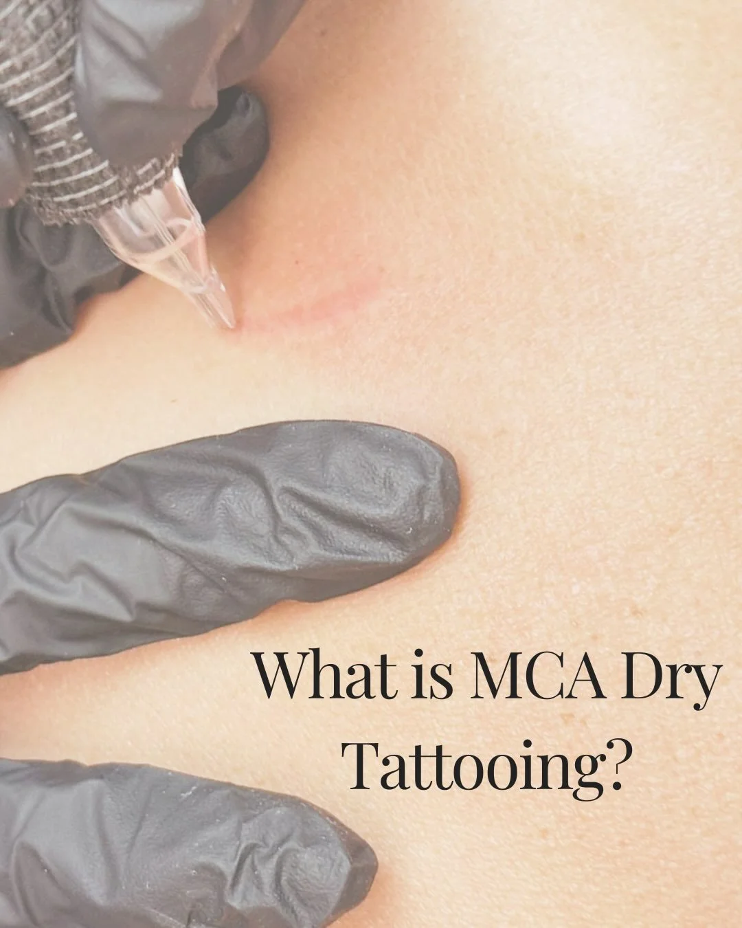 What is MCA Dry Tattooing?

MCA (Multitrepanic Collagen Actuation) dry tattooing is a non-pigment, skin rejuvenation treatment that uses a tattoo machine, but with a twist!

Instead of implanting ink, we use the device dry to create tiny micro-channe