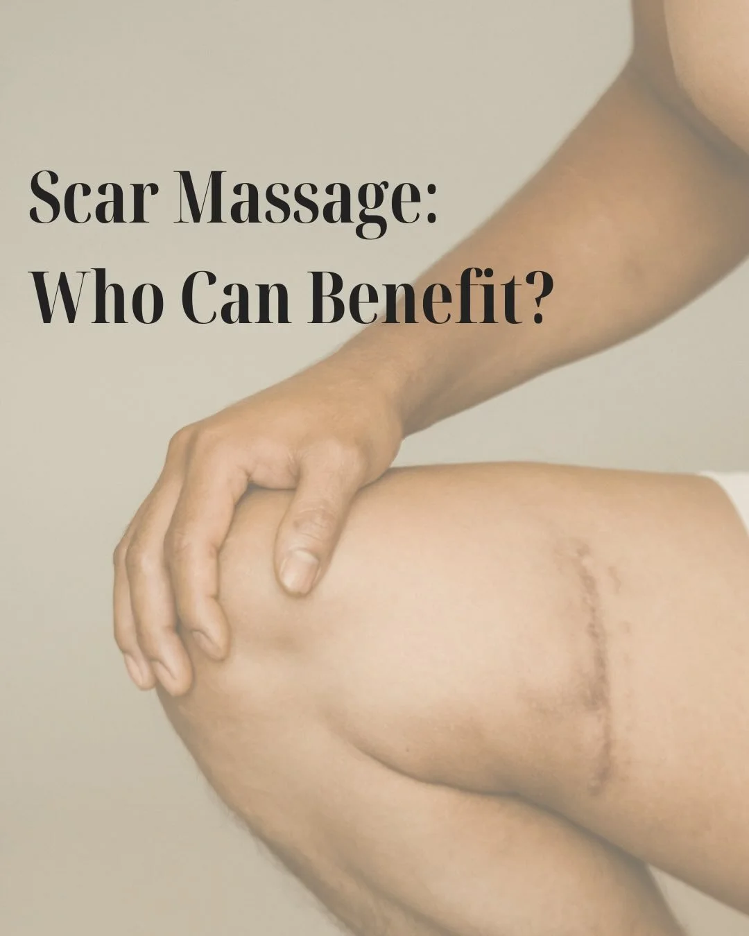 ✨ Scar massage: when it helps ✨

Not every scar needs massage! And that&rsquo;s completely okay.

Scar therapy can be helpful for some people, depending on how a scar feels, moves and responds to load.

It may be useful if a scar feels:
&bull; tight 