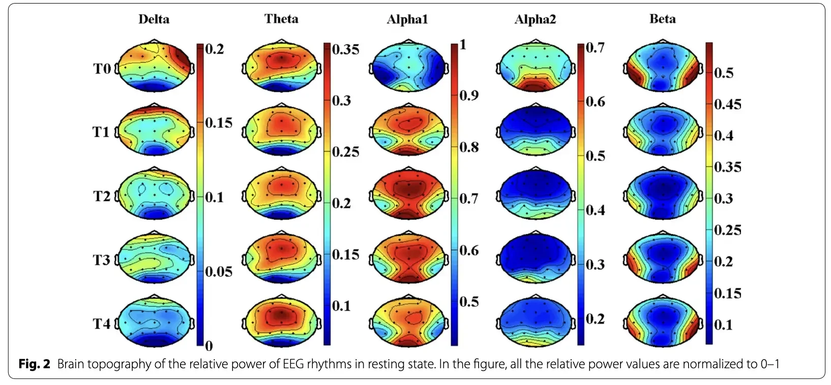 Example of a resting state
