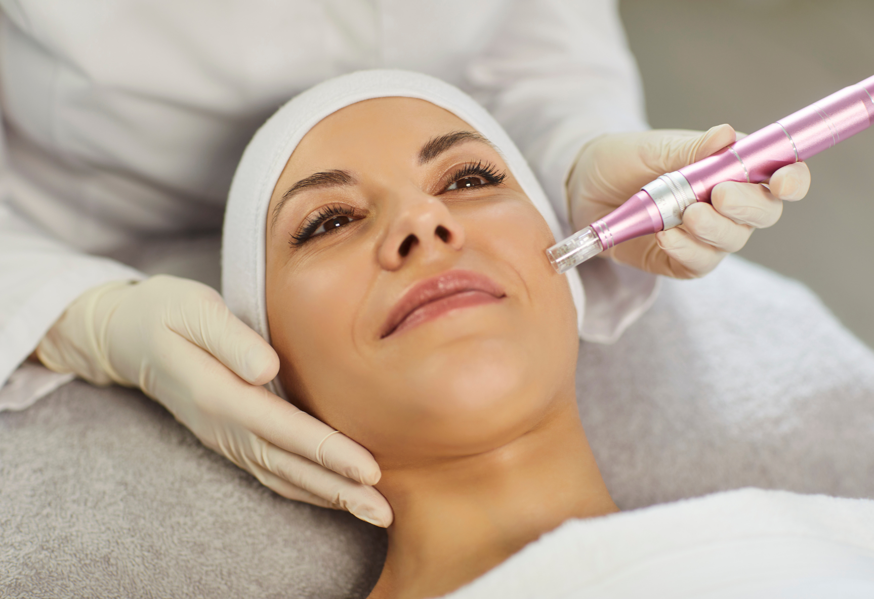 Microneedling and PRP in North Canton, Canton, Massillon, Akron, Kent, Fairlawn.