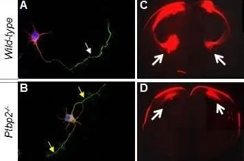 A Match Made in Neural Heaven: How a Neuron Grows an Axon