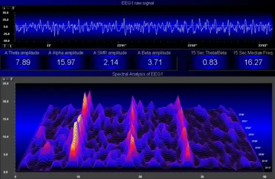 Computer screen displaying EEG raw signal and spectral analysis graphs with amplitude measurements and spectral peaks. Lucia Light Therapy at Spirit Well Sensory Lounge in Stuart Florida.