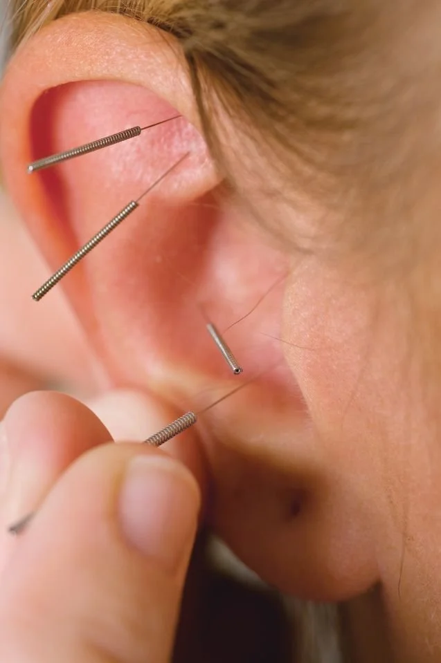Person inserting thin, metallic, spring-like earring hooks into a pierced ear with existing earrings. Ear Acupuncture Therapy at Spirit Well Sensory Lounge in Stuart, Florida.