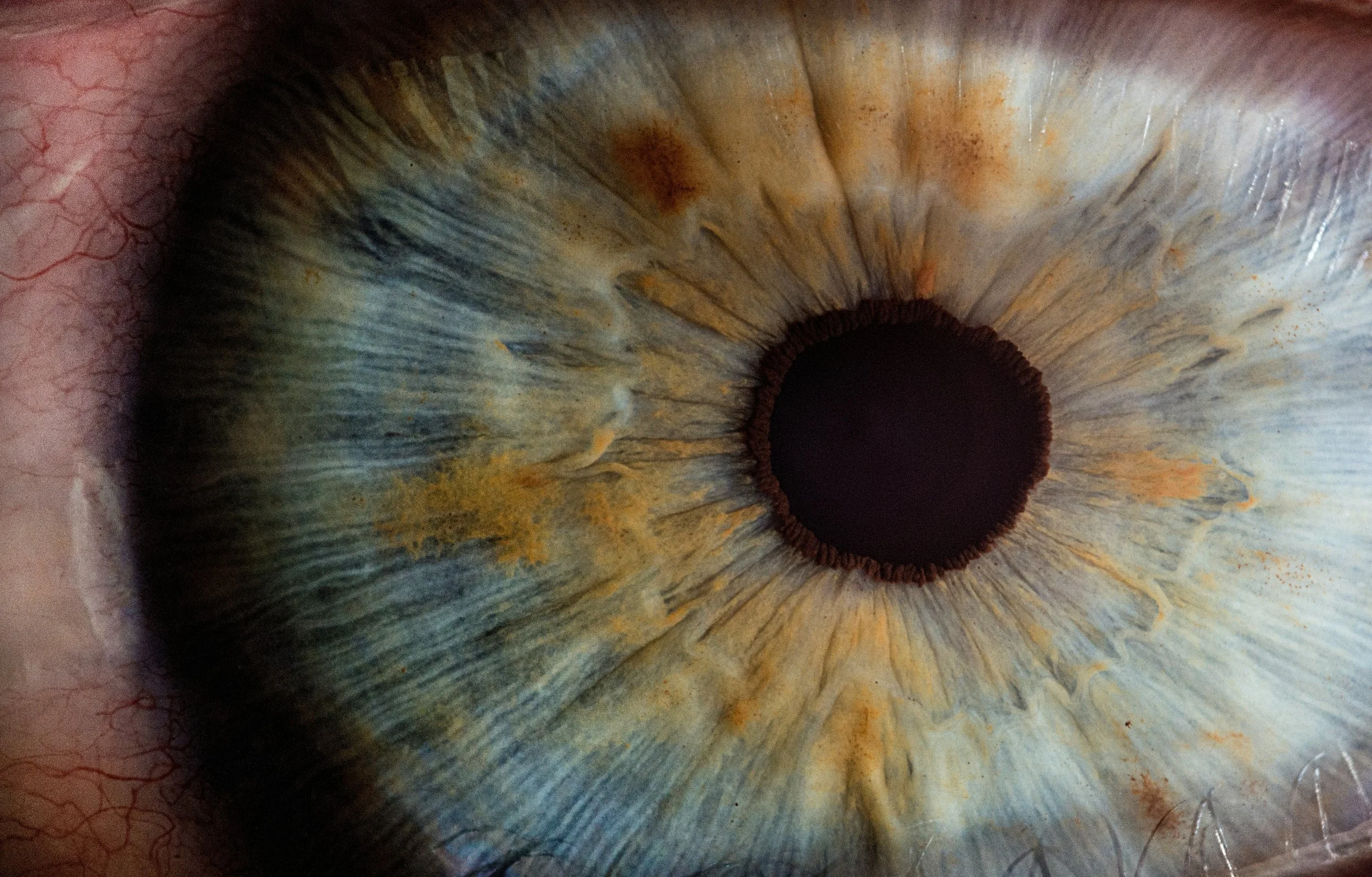 Close-up of a human eye with a detailed iris featuring green, yellow, and blue hues, a black pupil, and blood vessels around the sclera.