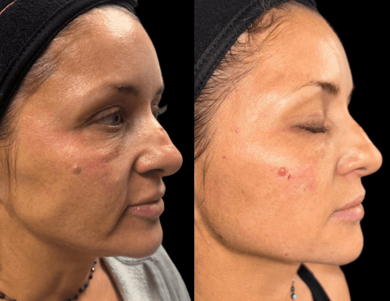 Medspa in Gilbert AZ 85295 l Blog 63