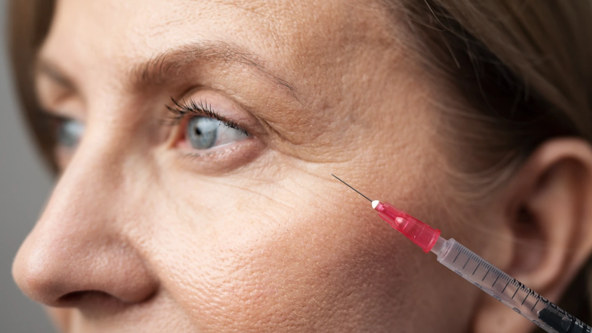 How to Smooth Away Wrinkles with Neurotoxin Injections
