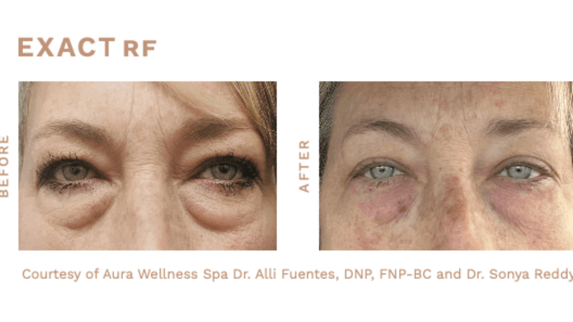 Medspa in Gilbert AZ 85295 l Blog 70