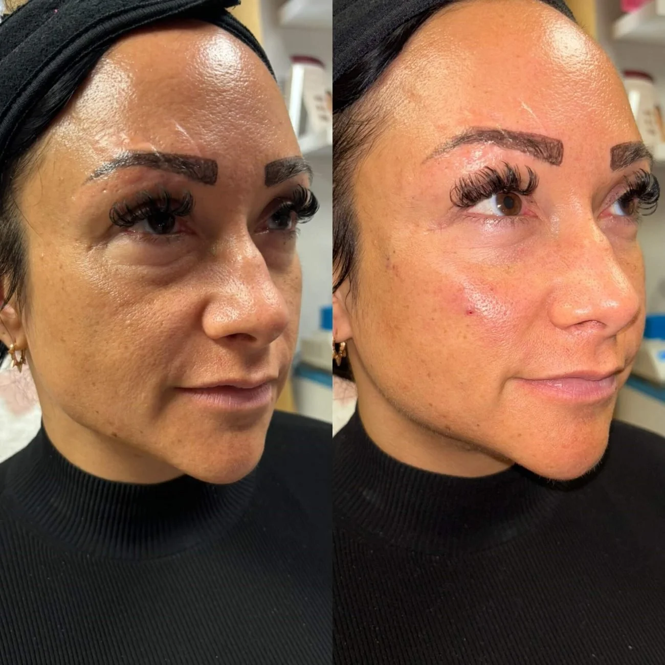 Medspa in Gilbert AZ 85295 l Blog 50