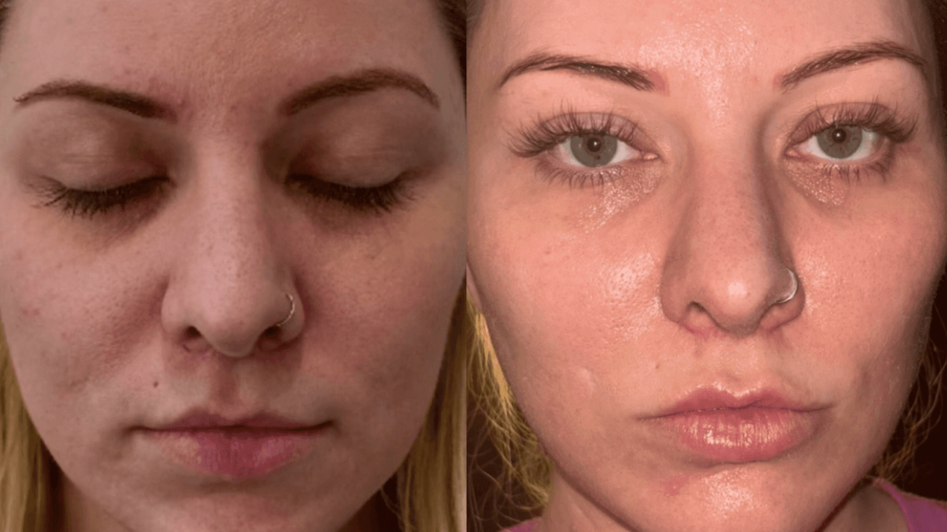 Medspa in Gilbert AZ 85295 l Blog 82