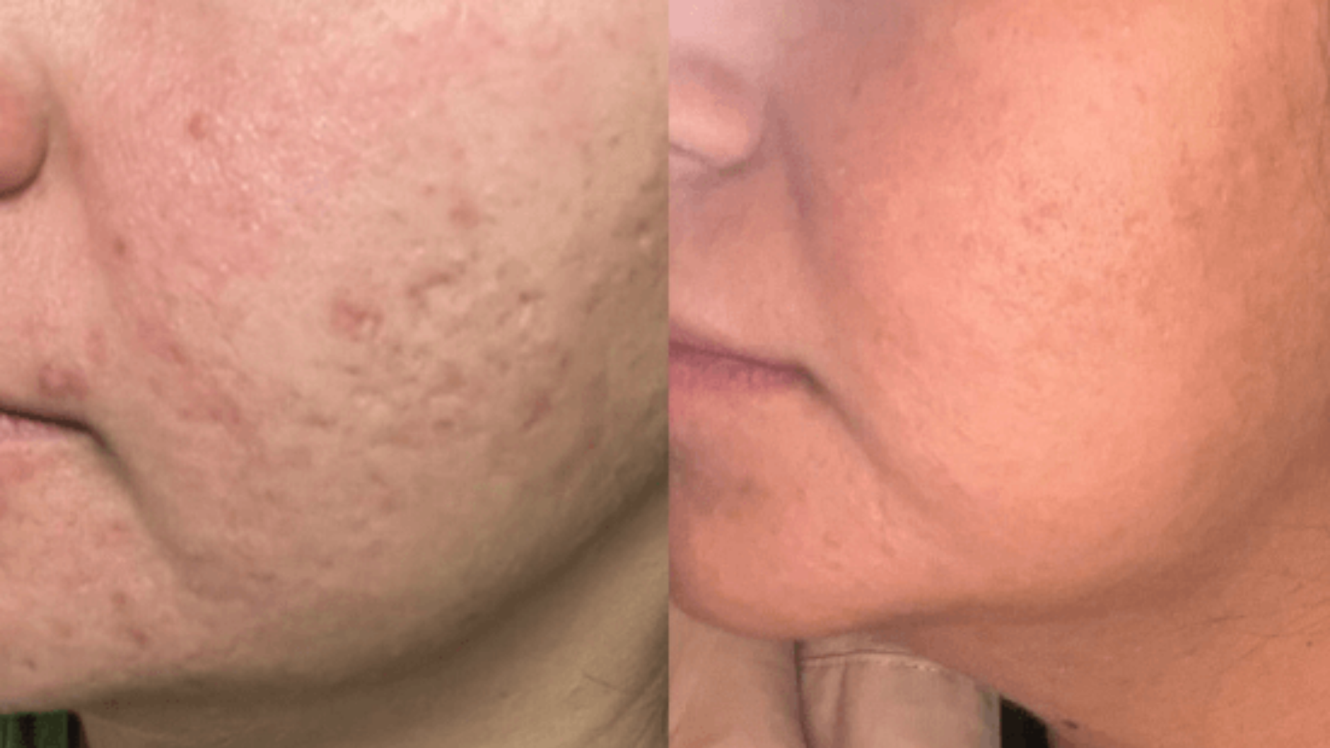 Medspa in Gilbert AZ 85295 l Blog 85