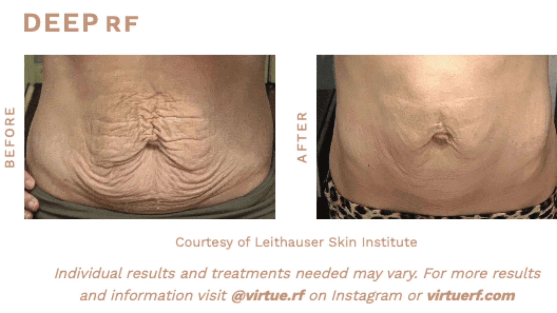 Medspa in Gilbert AZ 85295 l Blog 69