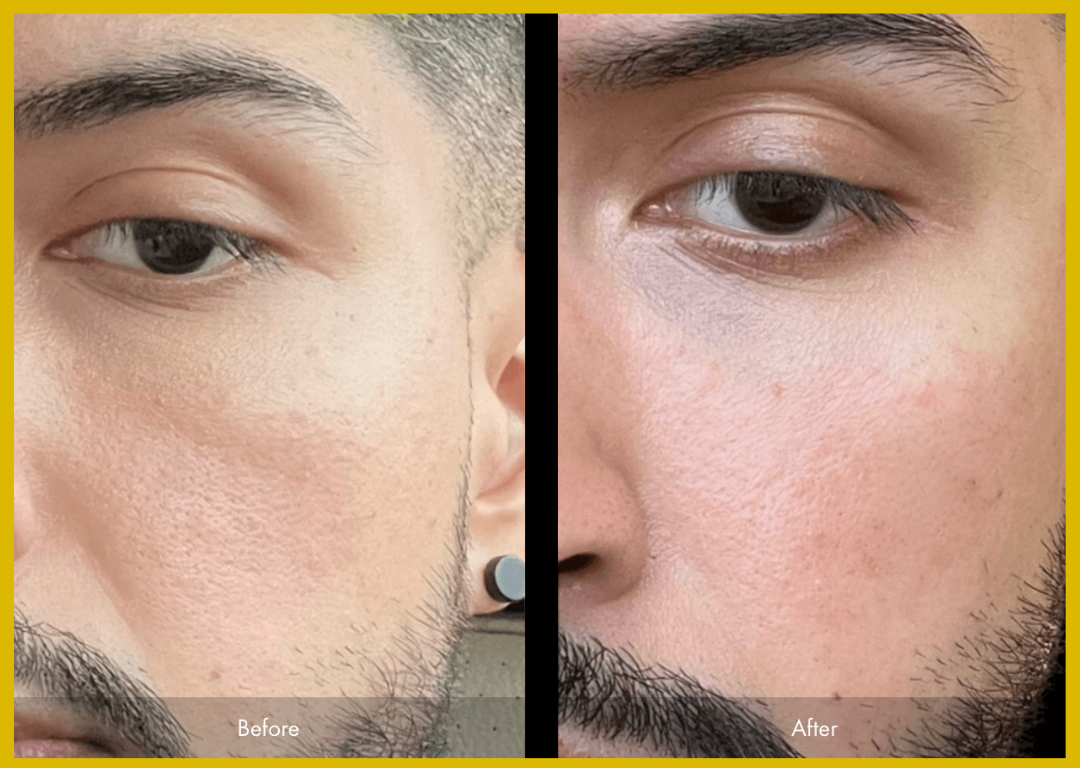 Medspa in Gilbert AZ 85295 l Before and Afters
