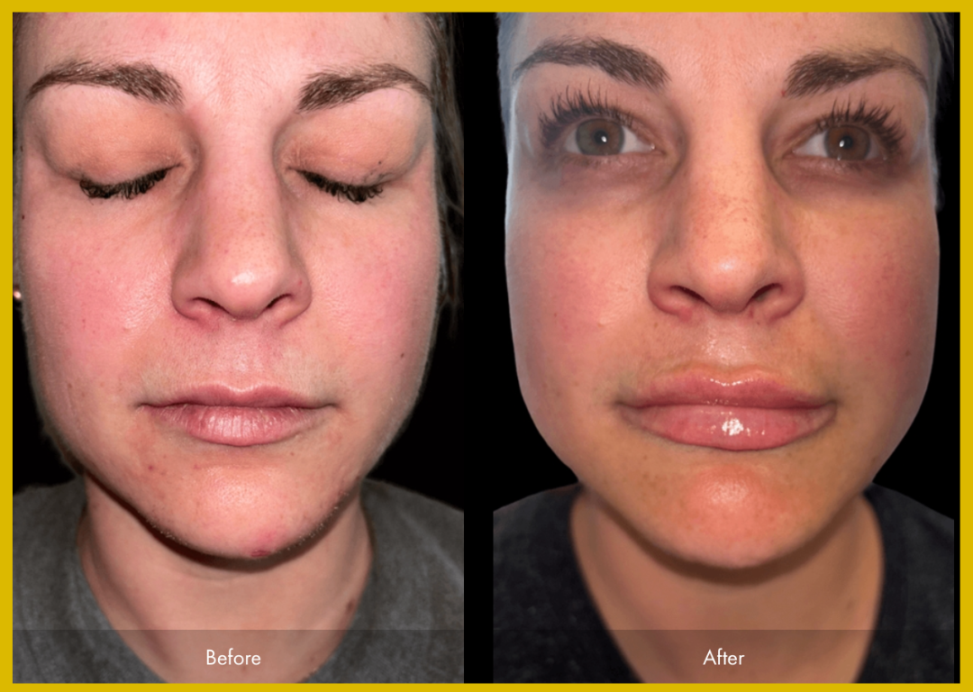 Medspa in Gilbert AZ 85297 l Before and Afters