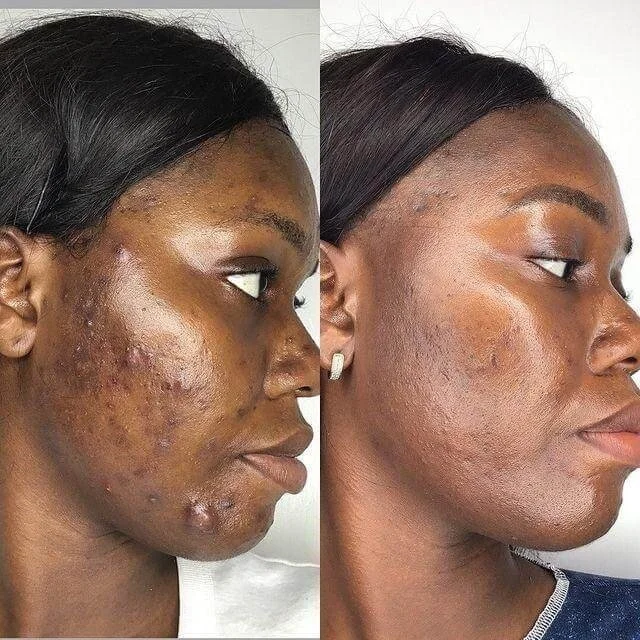 Medspa in Gilbert AZ 85295 l Blog 62