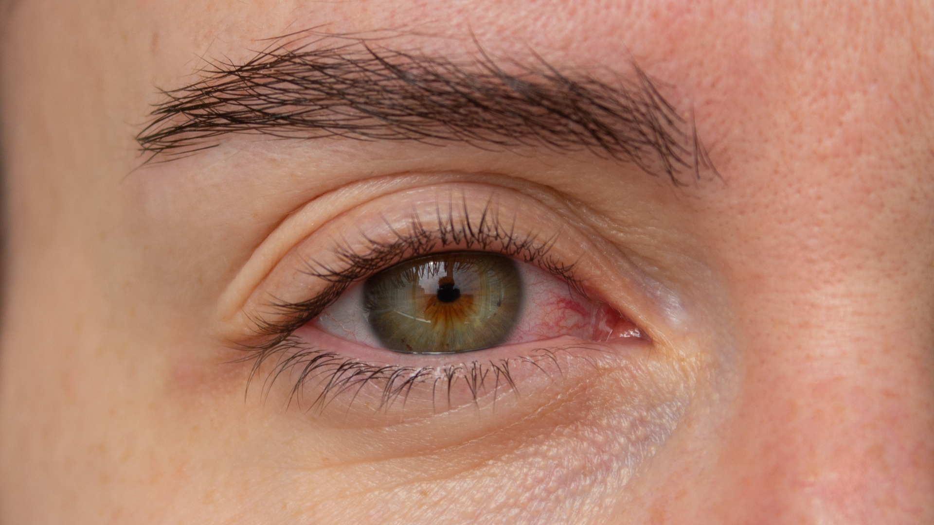 Medspa in Gilbert AZ 85295 l Blog 23