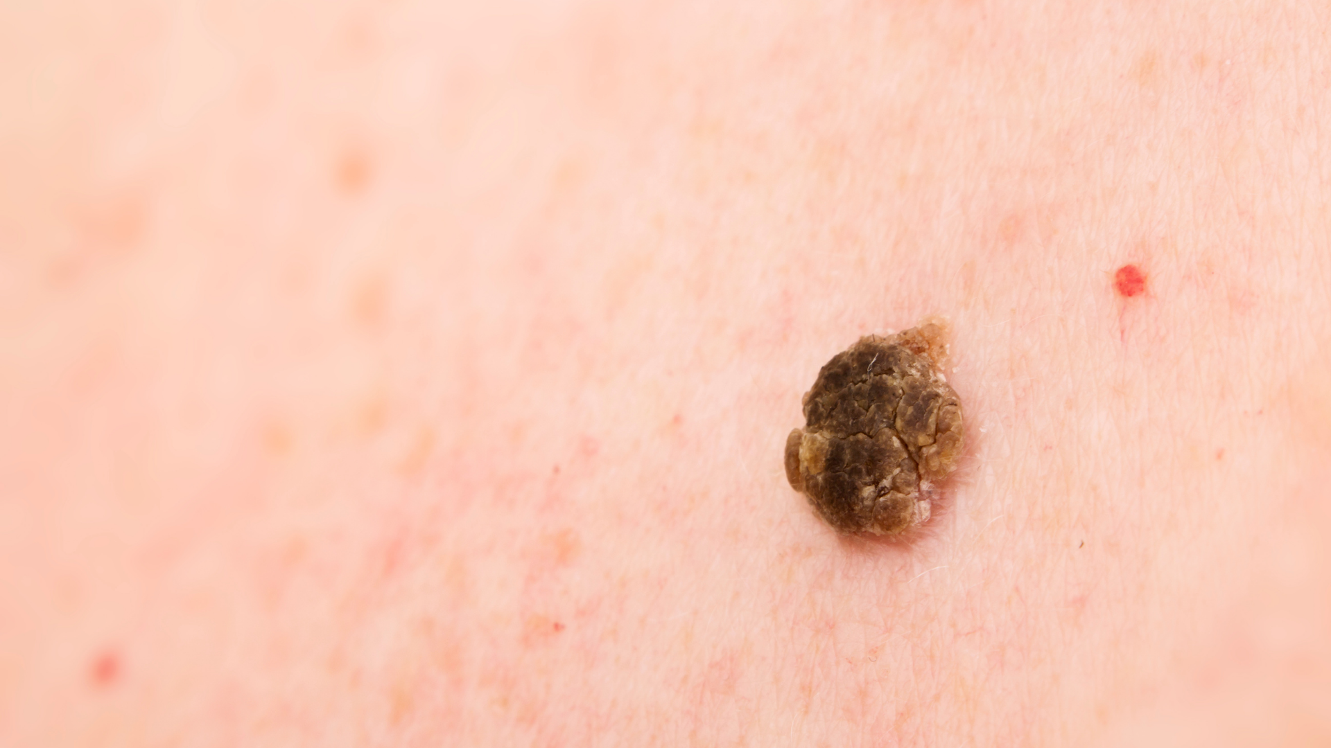 Medspa in Gilbert AZ 85295 l Blog 30