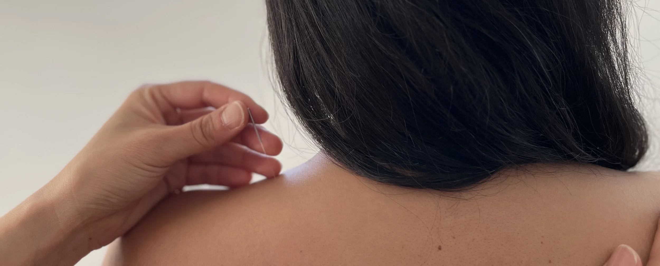 A hand gently inserts a fine silver needle into the brown-skinned shoulder of a person with long black hair.