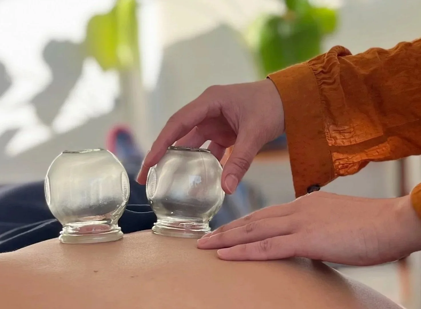 Close up of a hand placing a glass cup on a patient's back. Green leaves in the background.