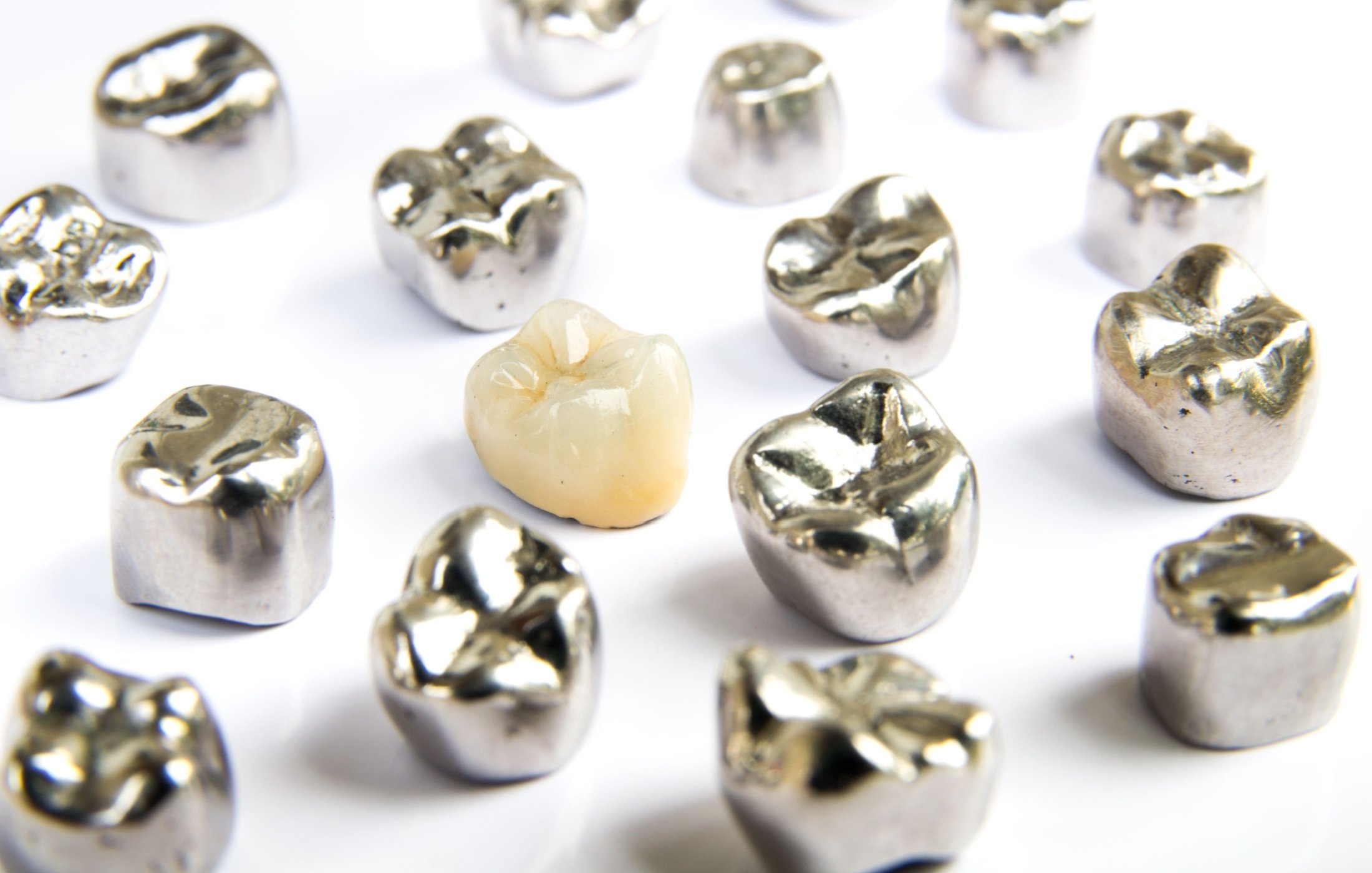 Tooth-Colored Fillings vs. Silver Fillings: What’s Best for Kids?