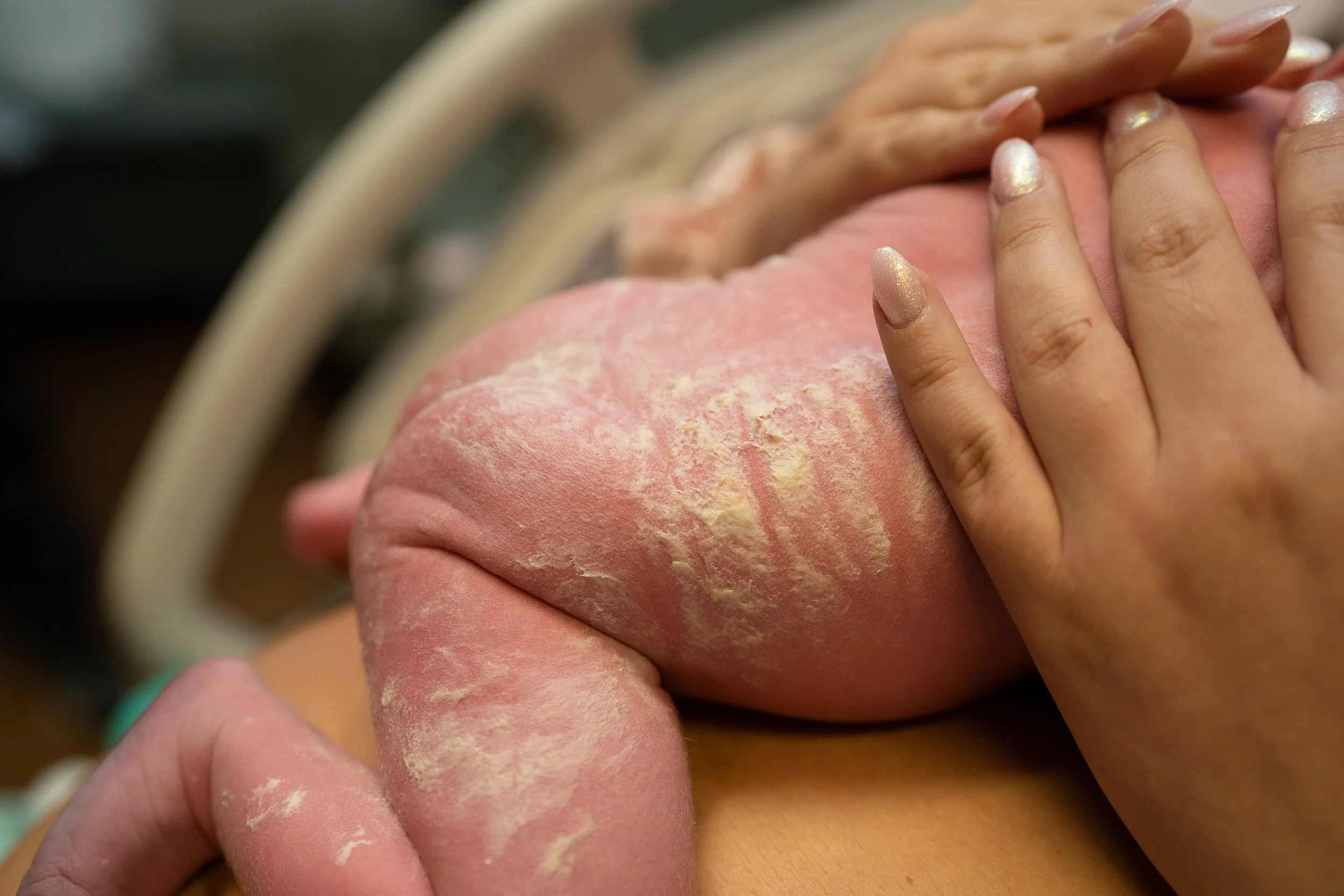 Newborn covered in vernix laying on mom's stomache.