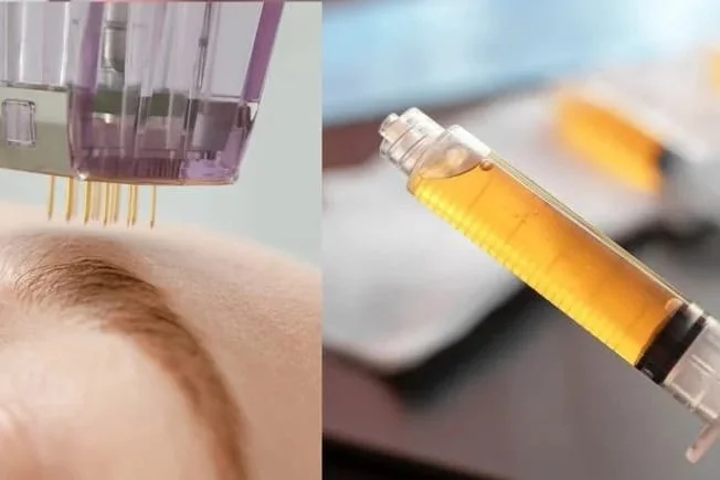 A-Complete-Guide-To-PRP-Microneedling-Recovery-1.jpg