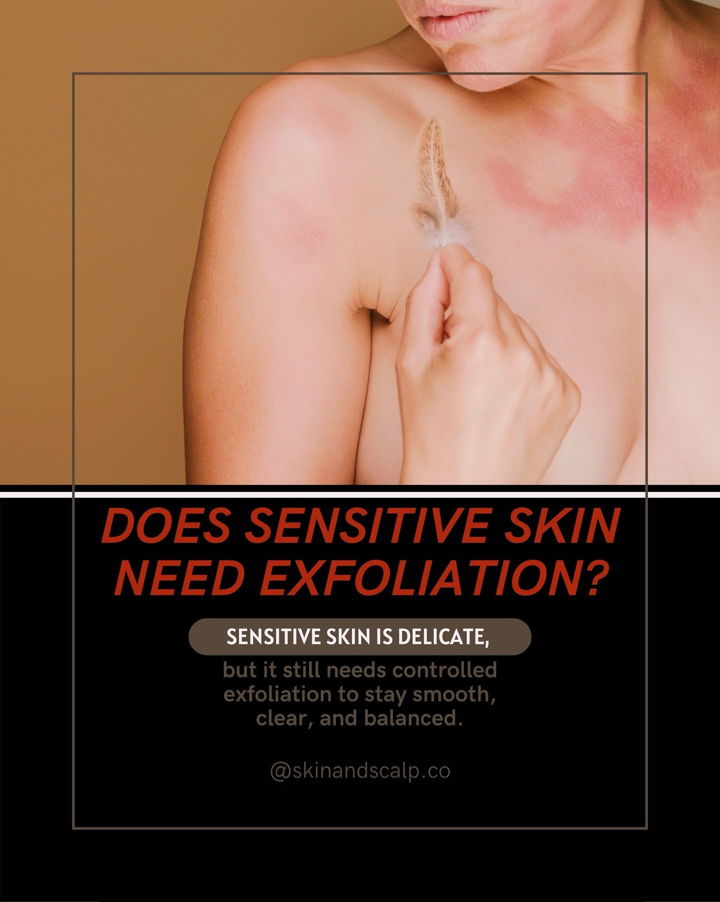 @skinandscalp.co Sensitive skin doesn&rsquo;t need more pressure.
It needs understanding.

Exfoliation should support the skin barrier&mdash;not challenge it.
When done gently, it clears buildup, refines texture, and restores balance without irritati
