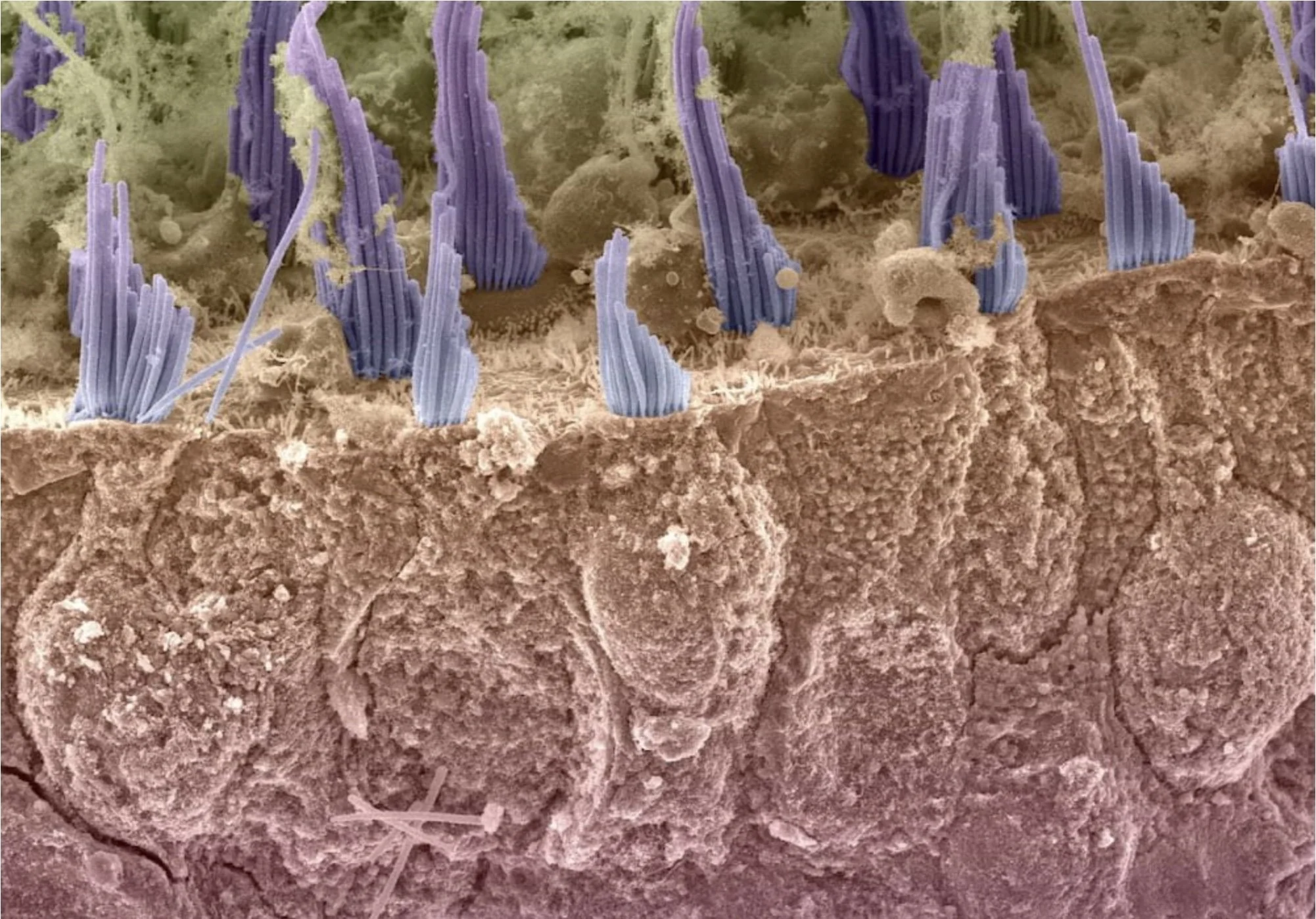 otoliths-1.jpg