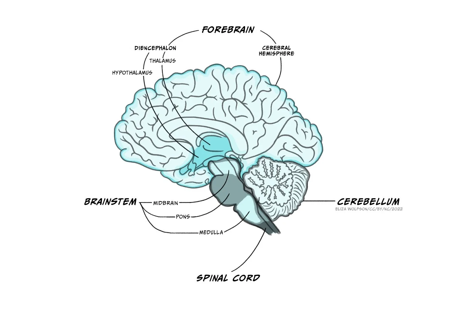 eliza-wolfson-brain-sagittal.jpg