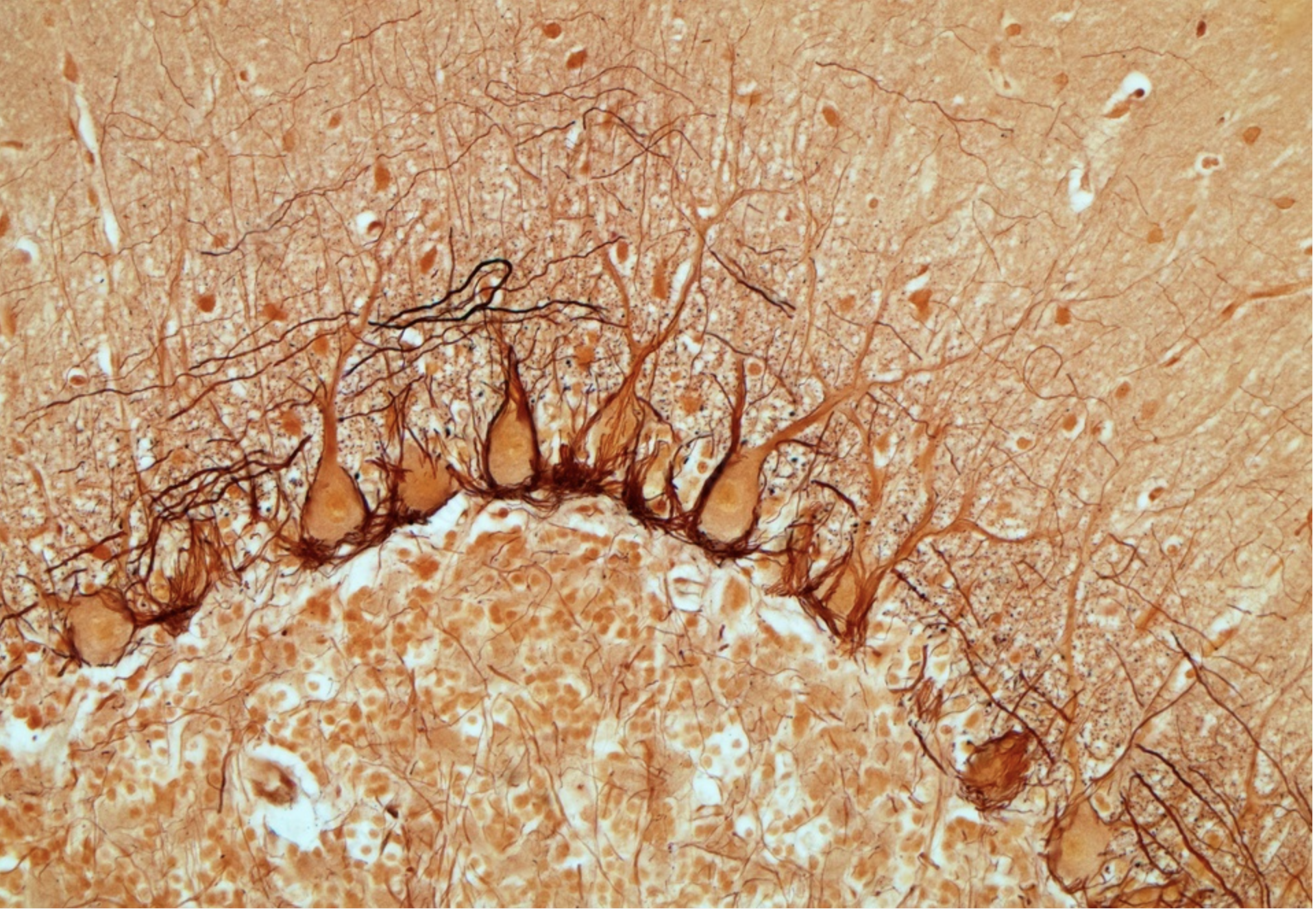 Purkinje cells.png