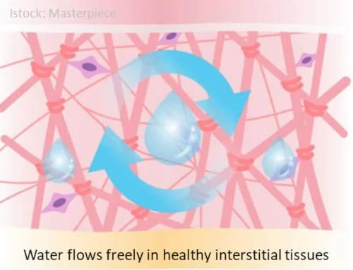 Fluids flow freely in healthy interstitial tissues