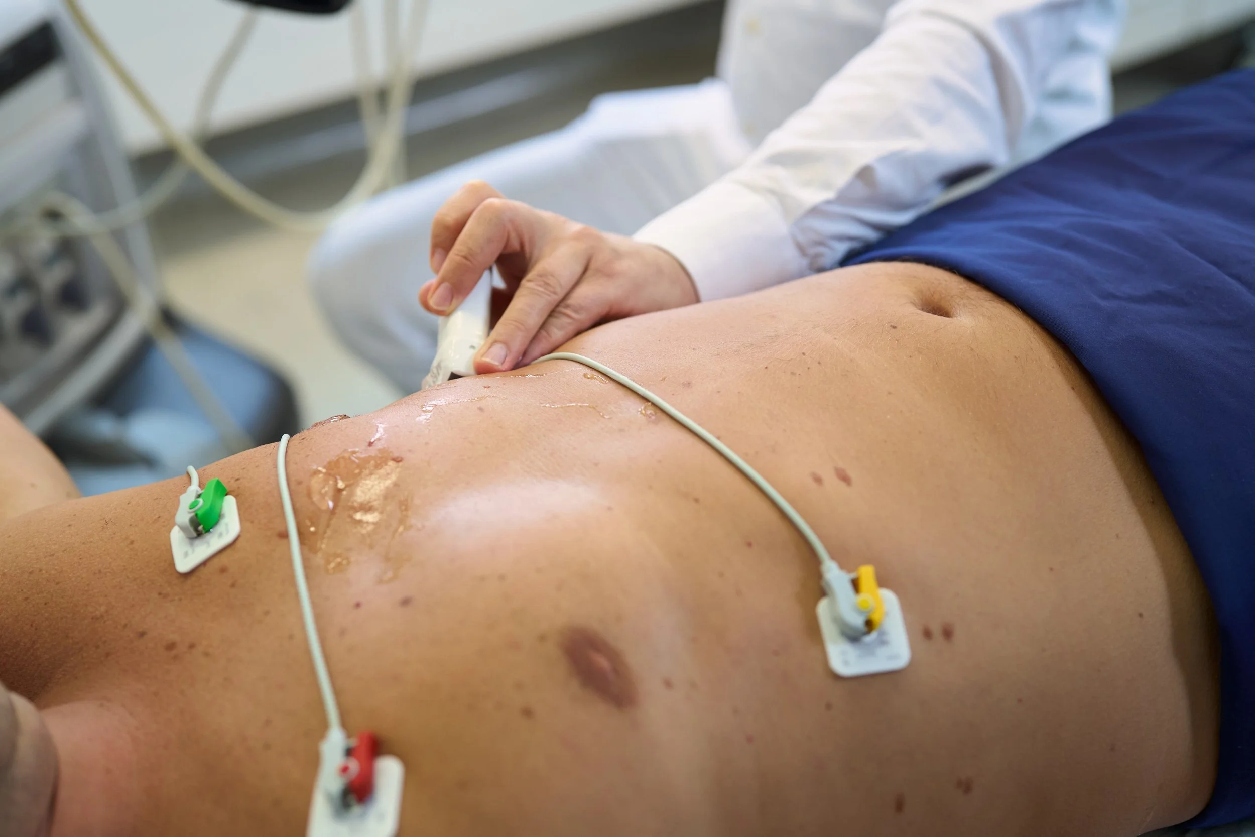 Paracelsus Kliniken beteiligen sich an den bundesweiten Herzwochen 2025